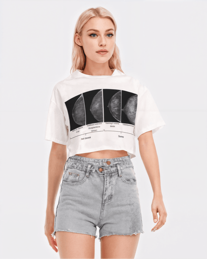 Woman wearing a white crop top with black graphic design and light blue shorts on a white background. The graphic is a mammogram 